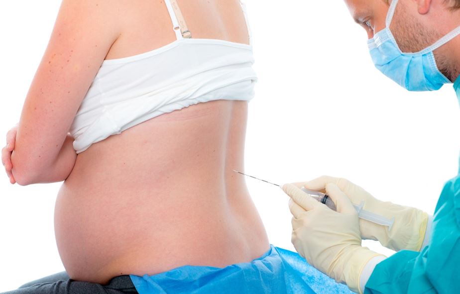 ¿Cómo funciona la epidural? Lo que debes saber